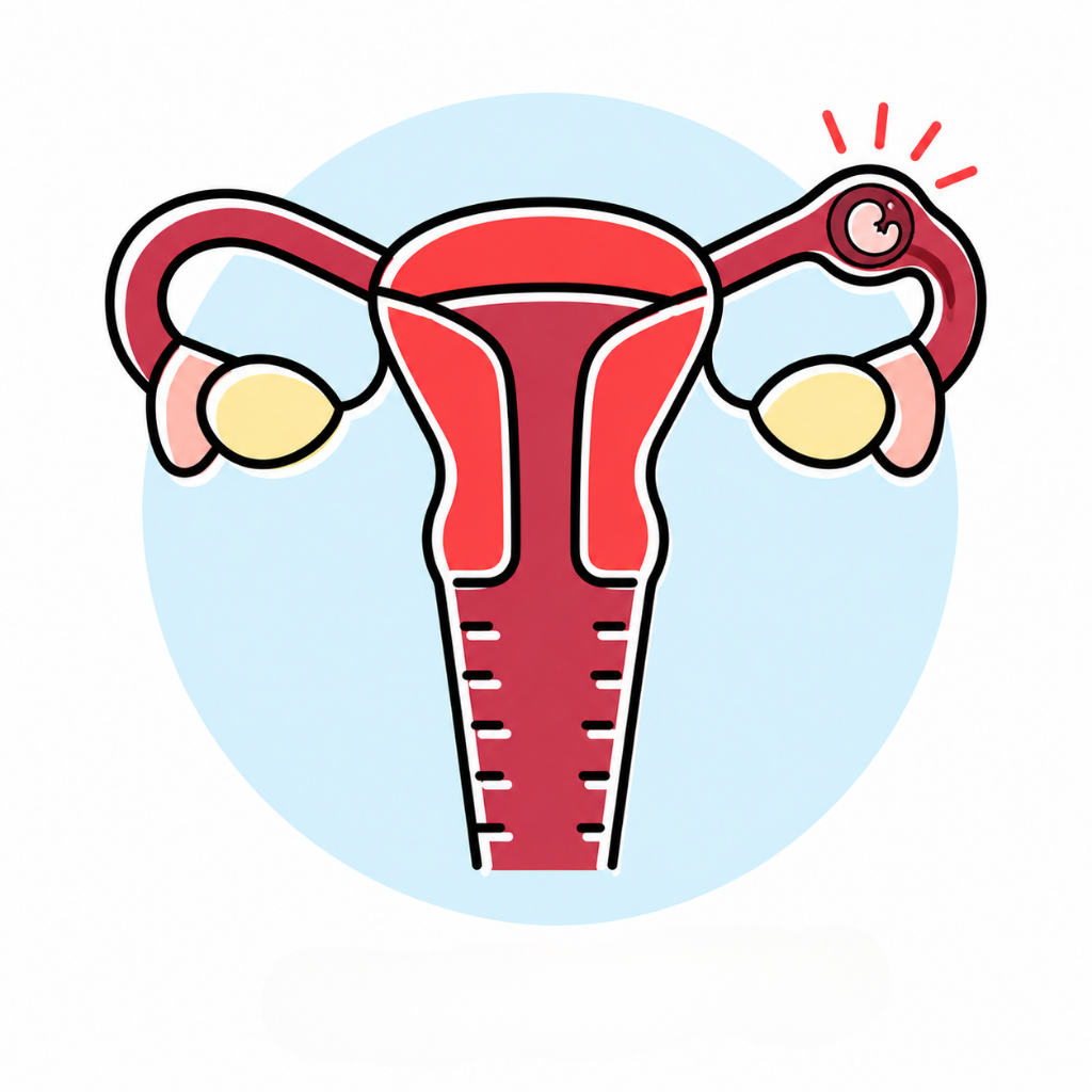 Ectopic Pregnancy