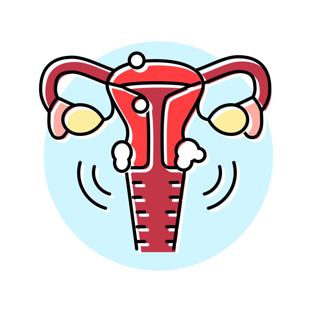 fibroids